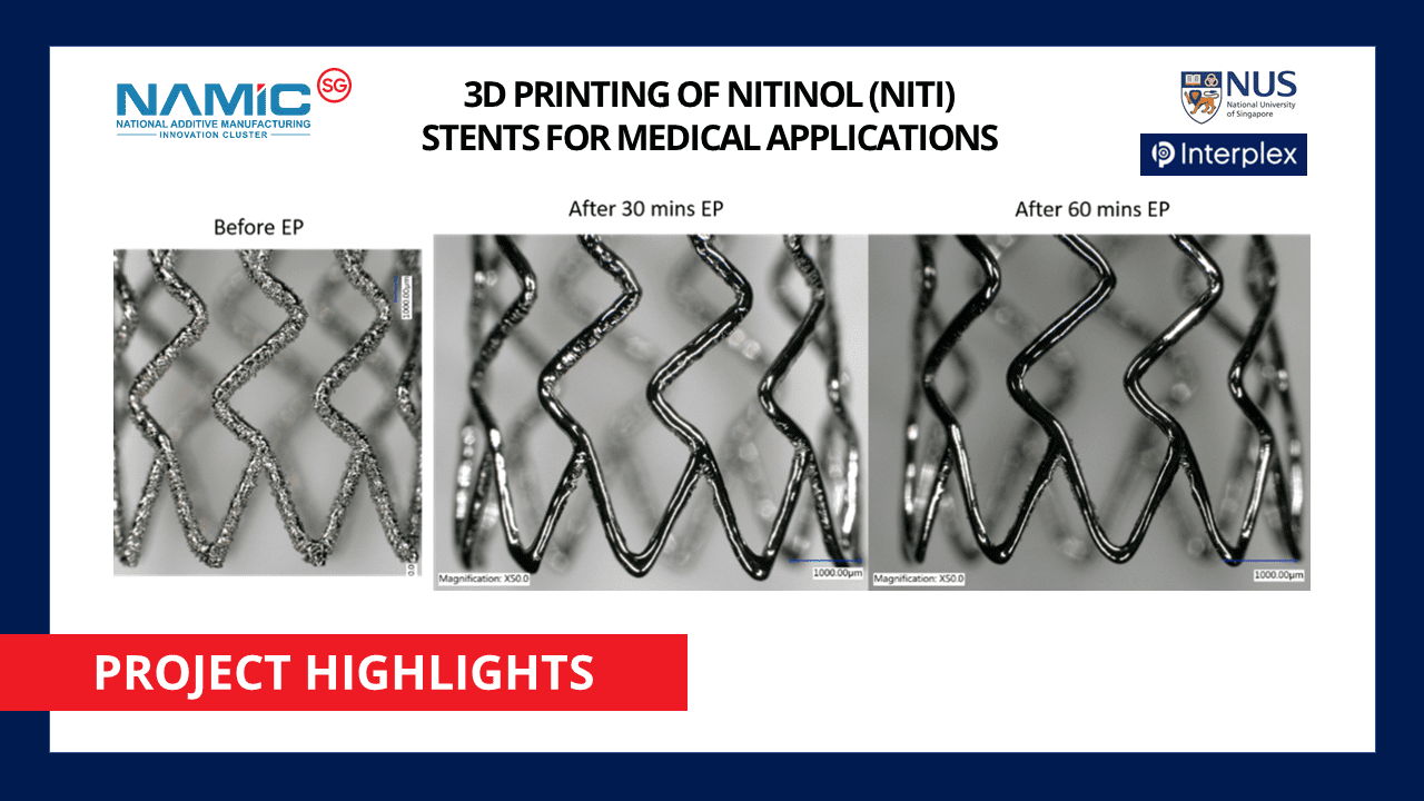 NAMIC Project Highlights 3D Printing Of Nitinol (NiTi) Stents For